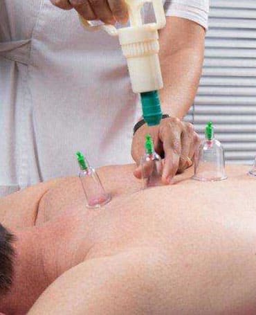 Acupuncture Types of treatment